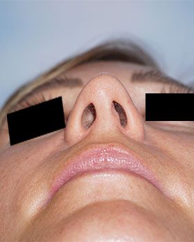under-before135D5B88-A920-DB43-49C6-E7047FB2E28A.jpg