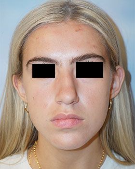 front-beforeD65D06D9-E498-5FBF-D95D-1039F1D8D284.jpg