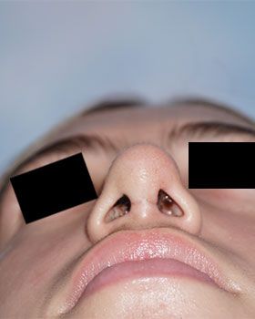 under-after1038A589-622A-A08D-3C2E-142E4D74B081.jpg